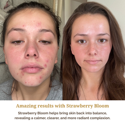 Strawberry Bloom